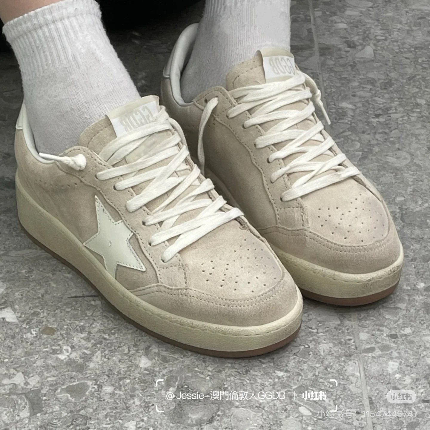 골든구스 5cm 여자 스니커즈 신발 운동화